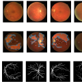 Semantic Image Segmentation